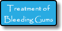 Treatment of Bleeding Gums